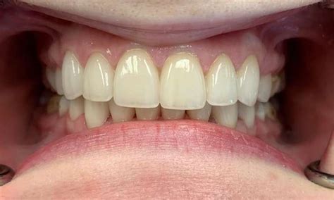 woodbury mn dentist