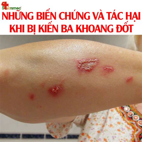 kien  khoang  hoi duoc hoc tphcm