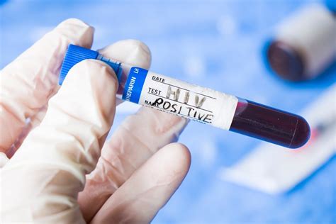 Через сколько времени и как проявляется ВИЧ-инфекция? | MedAboutMe