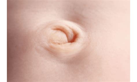clean  belly button belly button infections