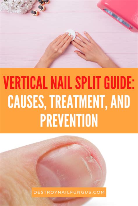 Repair A Split Nail