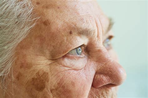 Alzheimer's Disease Piecing Together The Evidence Answer Key 4