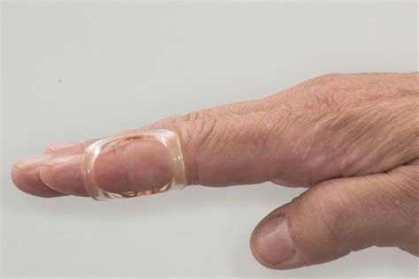 Crooked Finger | Support Unstable Joints | Arthro-Eze