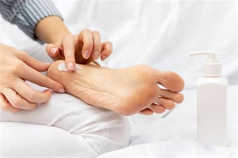 10 способов вылечить трещины на пятках | MedAboutMe