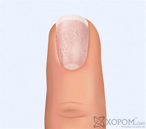 Хумс таны эрүүл мэндийн байдлыг тодорхойлно