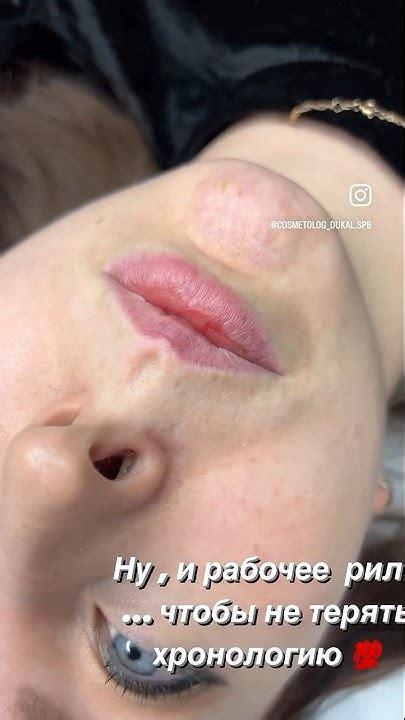 Губы - Чайка … не не слышали #губы #косметолог #медсестра #beauty # ...