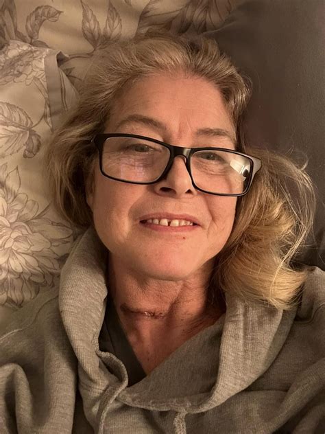 Sue Aikens Reveals Painful Surgery and Provides health update.