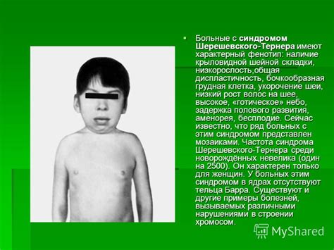 Презентация на тему: "Тема урока : Генетика человека. Наследственные ...