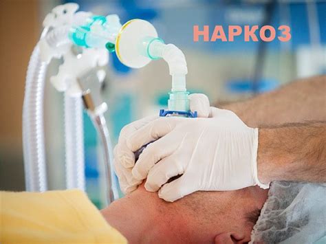 Наркоз, анестезия - презентация онлайн