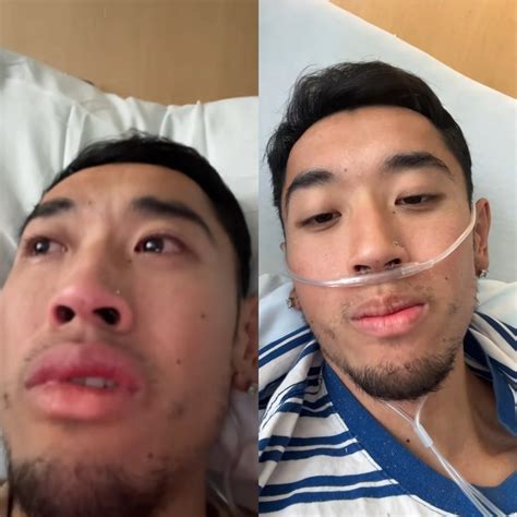 TikToker David Ngô mắc bệnh nặng, netizen phát hiện ấn đường rất tối