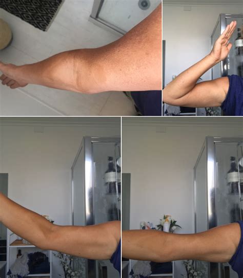 how to get rid of tan