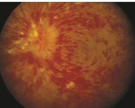 L1 Optical Coherence Tomography (OCT) part 2 Flashcards | Quizlet