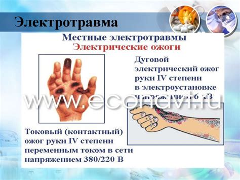 Понятие и виды травм. 8 класс - презентация онлайн