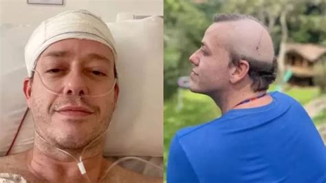 pablo sanabio revela luta contra tumor cerebral feed tv