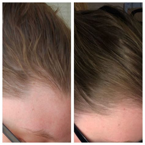 My hair is growing back!! 🤗 I have been using these new products on my