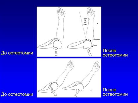 Повреждения и заболевания плечевого сустава - презентация онлайн