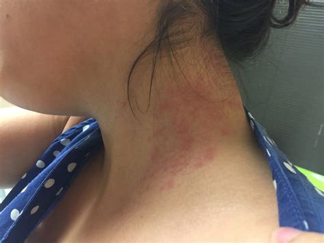 Von one adolescent era, ME take past draw on engine or is seem