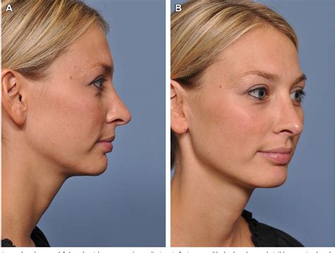 figure   anatomy  physiology   aging neck semantic scholar