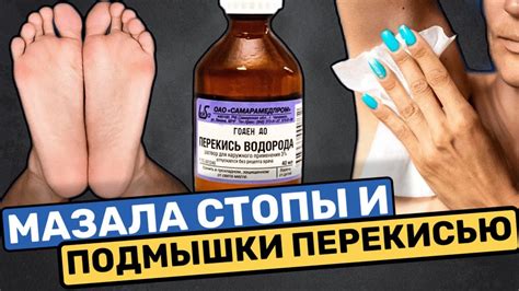 Годами Мучалась, а спас меня Перекись Водорода! Вот что произошло после ...
