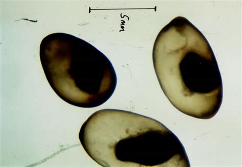 Taenia saginata