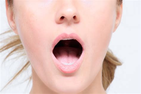 myofunctional exercises fort worth tx sleep dentist