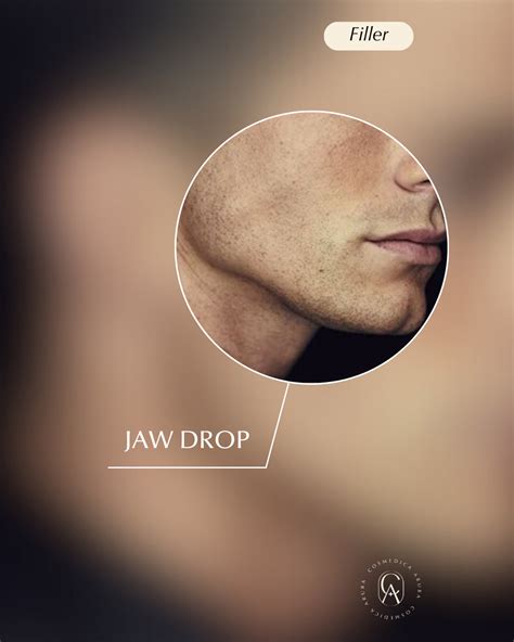 chin jawline cosmedica aruba