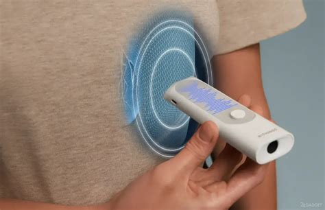 Withings BeamO — уникальный инструмент с ЭКГ и эндоскопом для ...