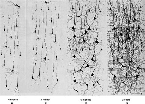 Mapping Early Brain Development in Autism: Neuron