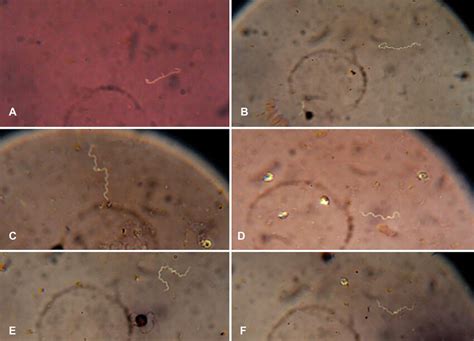 Microscopic observation of Leptospira with a 100× magnification optical ...