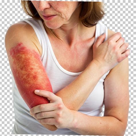 Closeup woman with big red scaly rash suffering on transparent
