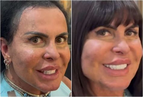 Gretchen Antes E Depois 2025 - Gretchen mostra antes e depois de manutenção capilar: 'Este cabelo tem ...