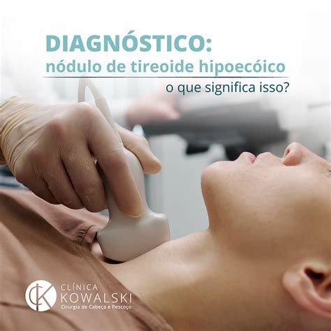 O Que É Nódulo Hipoecogénico - Diagnóstico de nódulo de tireoide hipoecóico: o que significa isso?