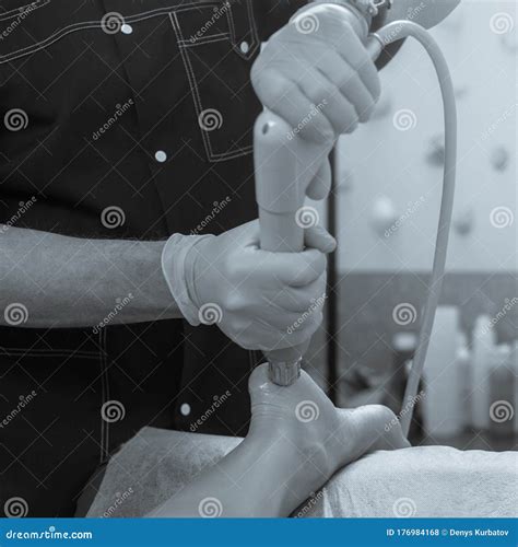 Shock waves therapy stock photo. Image of doctor, device - 176984168