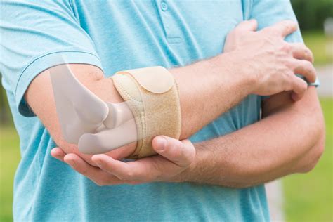 6 Effective Ways to Treat Elbow Tendon and Tendonitis - JOI