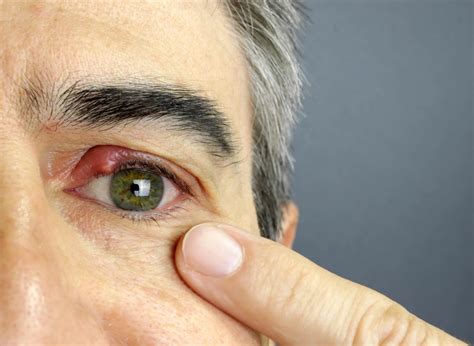 how to fix blurry vision after waking up
