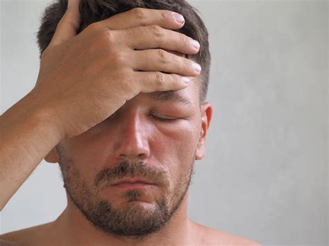 swelling   face  lips    culprits ear nose