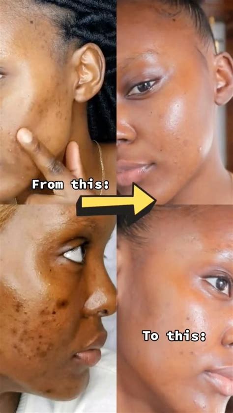 pin  skincare essentials