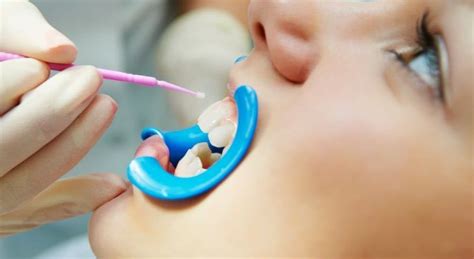 arrested caries treatment  east delhi