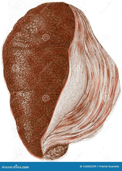 Interstitium Human Body Anatomy Stock Illustration | CartoonDealer.com ...
