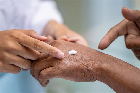 Skin Cancer Treatment Options — THE SKIN CENTRE