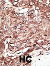 Anti-PRMT7 Rabbit Polyclonal Antibody | VWR