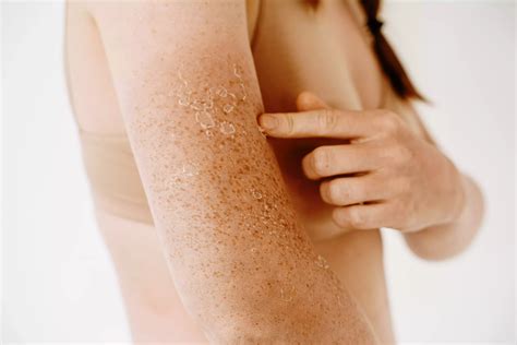 Coceira Pelo Corpo A Noite - Coceira noturna? Principais causas e dicas para aliviar