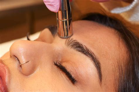 Lasers for Skin Resurfacing Grande Prairie, AB - Laser Treatments