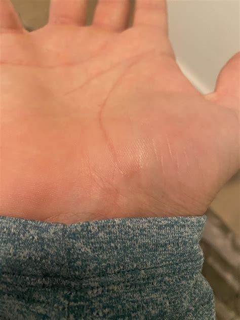 Help! I’ve been getting these sore red spots and feeling like I’m being