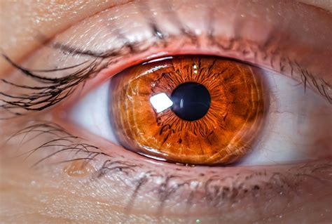 Advancements in Glaucoma Surgery: Cutting-Edge Eye Care