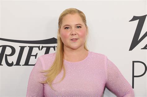 Amy Schumer Says Internet Trolls Diagnosed Her With Cushing Syndrome