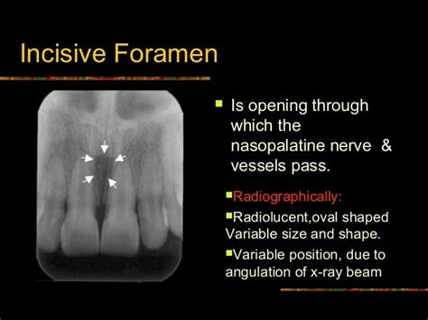 Intra Oral radiographic anatomical landmarks