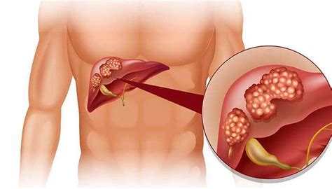 how long to abstain from alcohol before liver function test