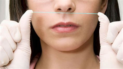 Unbelievable Blackhead Removal 2024: Get Rid Of Blackheads In 24 Hours? Image 19