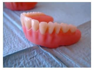 acrylic denture tradekorea